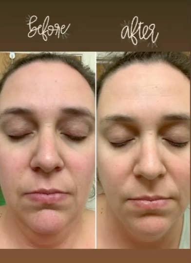 Hello Glow Face Mask | Skin Care | Facial Mask for Women